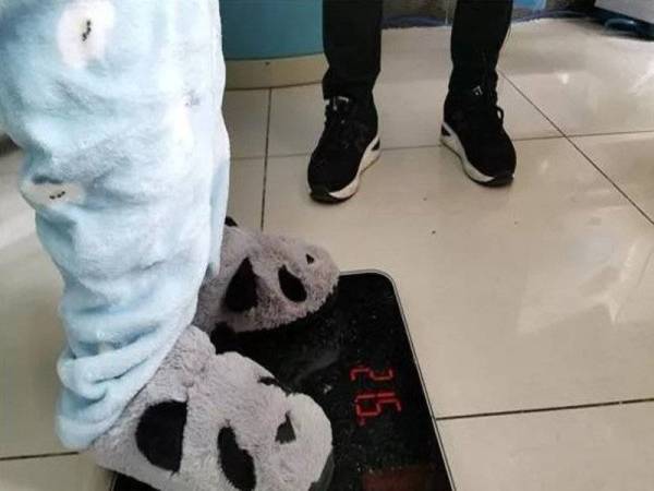 Berat badan Huayuan hanya 21 kilogram.