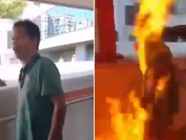 Mangsa mengalami kesan melecur tahap dua pada lengan dan dadanya akibat dibakar hidup-hidup kelmarin.