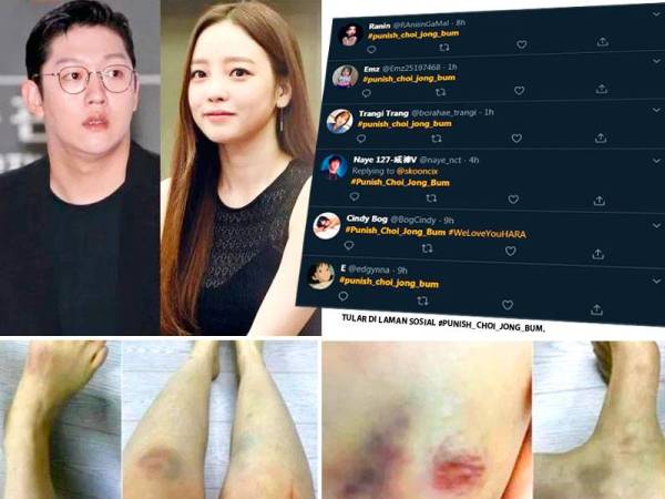 Goo Hara dipercayai didera bekas teman lelakinya. -Foto: Kimchi Daily