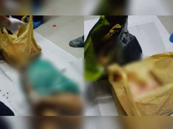 Foto dimuat naik tular di laman sosial.