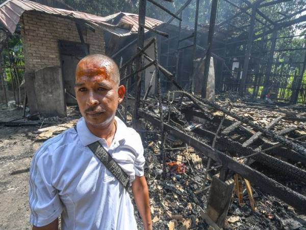 Mohd Zaini Ramli, 38, yang melecur di bahagian kepala kelihatan sugul mengenangkan nasibnya dan keluarga apabila rumah mereka musnah dalam kebakaran di Kampung Nechang hari ini. - Foto Bernama
