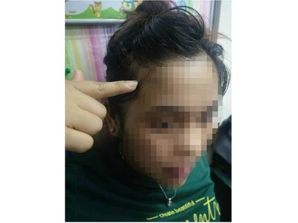 Mangsa mengalami kecederaan di kepala selepas ditampar dan kepalanya ditolak pada besi katil.