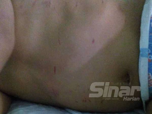 Kanak-kanak 3 tahun cedera akibat diserang kera.