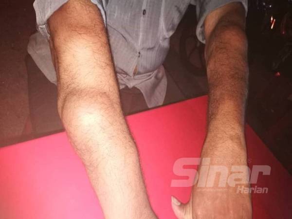 Abdullah menghidap penyakit jantung dan saraf.