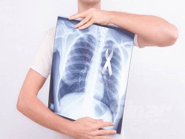 PEROKOK tegar berisiko tinggi menghidap kanser paru-paru.