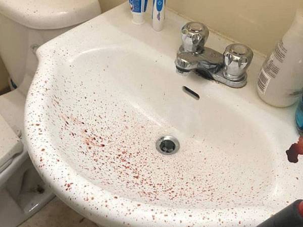 Percikan darah jiran dari tingkat atas yang terdapat pada sinki bilik air Adam Hockett.