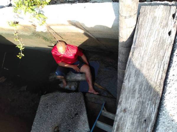 Amran alami cedera parah pada lutut akibat terjatuh ke dalam longkang besar(ihsan pembaca)