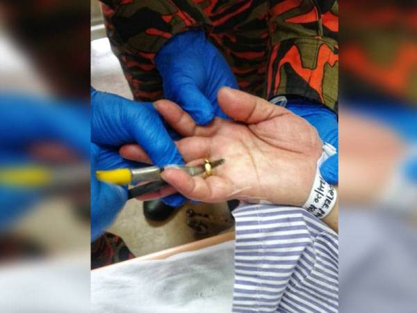 Anggota bomba menggunakan pemotong khas untuk mengeluarkan cincin pada jari mangsa. - Foto ihsan Bomba