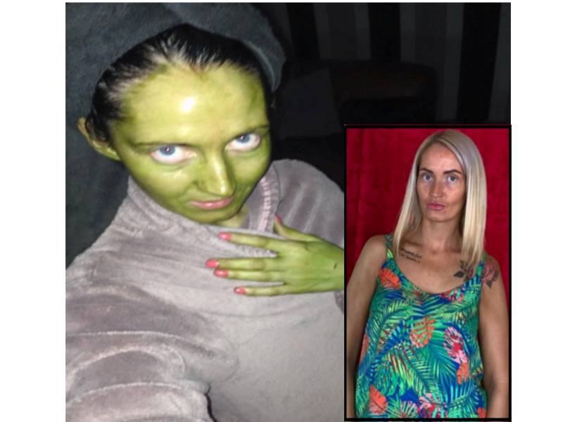 Jenni selepas menggunakan krim tersebut manakal gambar kanan sebelum menggunakan krim berkenaan. - Foto The Sun