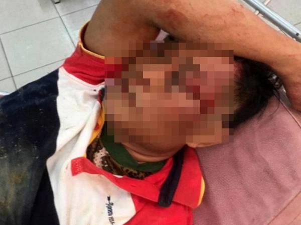 Warga Indonesia cedera dipercayai diserang gajah ketika cuba membuka pintu pagar Ladang Sungai Sayong, Kluang kelmarin. - Foto Bernama