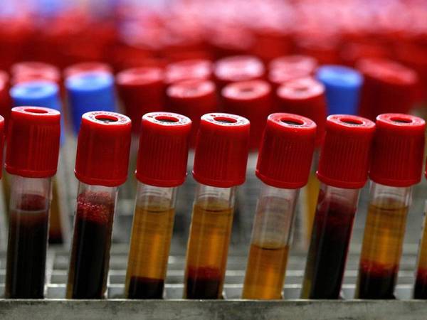 Pakar perubatan dunia masih menjalankan ujian terhadap keberkesanan kaedah plasma darah dalam mengubati pesakit Covid-19.