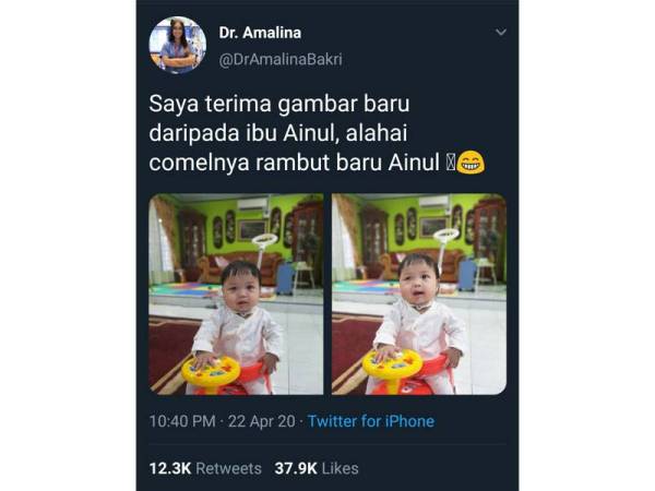 Pakar bedah warga Malaysia di United Kingdom (UK), Dr Nur Amalina Che Bakri berkongsi perkembangan Ainul Mardhiah di akaun Twitter miliknya.