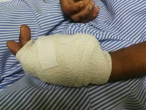 Mangsa yang mengalami kecederaan di beberapa bahagian badan kini dirawat di Hospital Teluk Intan. - Foto IPD Perak Tengah