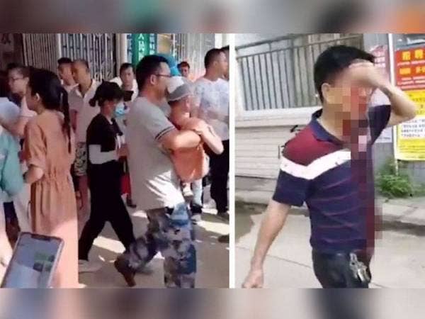 Seramai 37 pelajar cedera ringan sementara dua guru mengalami kecederaan teruk selepas diserang lelaki bersenjatakan sebilah pisau di Sekolah Rendah Pusat Wangfu, China hari ini. Foto: Agensi