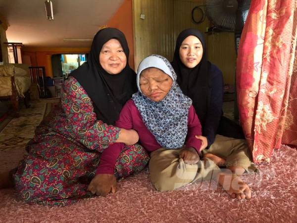 Raihanah (kiri) menjaga dan menguruskan semua keperluan Siti Nuratikah sambil dibantu anak bongsunya, Siti Nur Shalehah dan sembilan lagi adik-beradik yang lain.