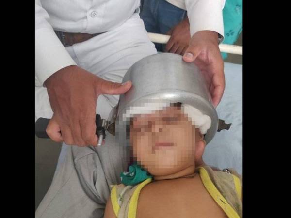 Seorang kanak-kanak perempuan terpaksa menahan kesakitan selepas kepalanya tersangkut di dalam sebuah periuk ketika sedang bermain di kediamannya di Rajkot, India kelmarin.