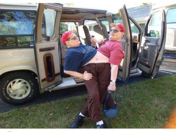 Ronnie dan Donnie pasangan kembar siam tertua di dunia sejak 2014 dilapor meninggal dunia semalam. - Foto Daily Star