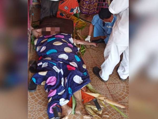 Mangsa yang melecur 50 peratus pada kaki dan tangan dalam kebakaran di Simpang Ampat, Nibong Tebal petang tadi kini dirawat di Hospital Sungai Bakap.