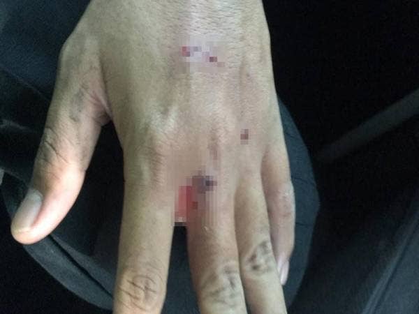 Seorang anggota AADK Kuala Muda cedera terkena kayu yang dibaling seorang penagih dadah dalam operasi di sekitar Kuala Muda, semalam.