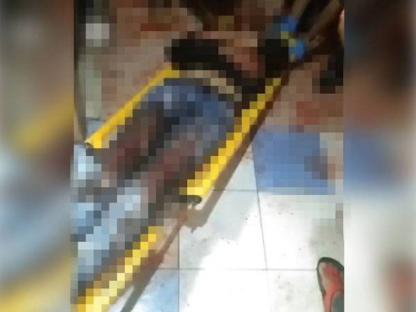 Mangsa terbaring selepas di tetak bertubi-tubi di rumahnya di Wakaf Mek Zainab semalam.