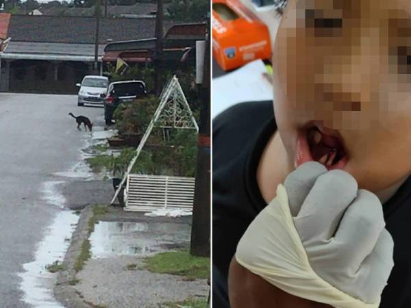 Anjing liar yang mengejar Muhammad Rayyan masih berkeliaran di taman perumahan tersebut. - Foto ihsan Nazarfitri Gambar kanan: Muhammad Rayyan mengalami kecederaan di muka dan patah gigi selepas melarikan diri daripada anjing liar semalam. - Foto ihsan Nazarfitri