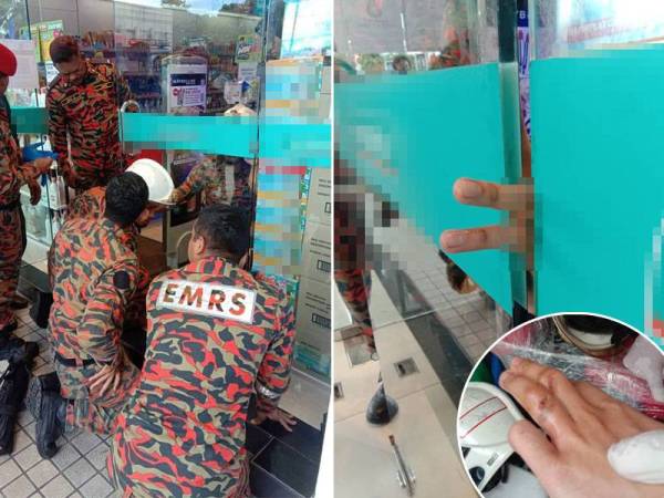 Jari mangsa yang tersepit pada pintu kaca automatik di sebuah premis perniagaan di Bukit Jambul, Georgetown hari ini.