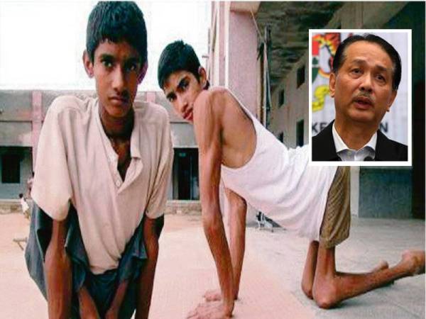 Polio adalah penyakit berjangkit disebabkan virus polio yang menyerang sistem saraf manusia dan boleh menyebabkan kelumpuhan kekal selain menyebabkan kegagalan pernafasan dan membawa maut. Gambar hiasan. Gambar Kecil: Dr Noor Hisham Abdullah