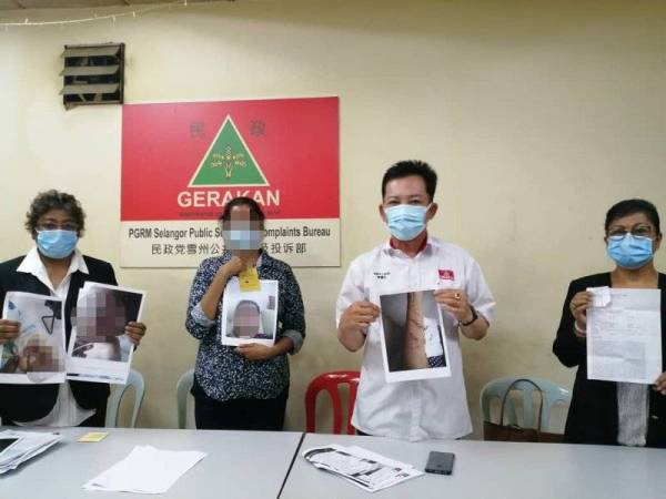 Rajes menunjukkan bukti dirinya serta anaknya didera bekas kekasihnya.