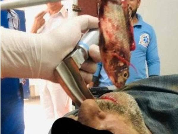 Nelayan nyaris maut selepas ikan masuk dalam kerongkongnya. - Foto Agensi