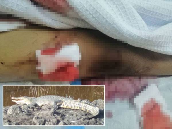 Mangsa mengalami kecederaan pada bahagian badan, kaki kanan dan perut akibat digigit buaya dalam kejadian di sungai di Kampung Mengkabong, Tuaran kini dirawat di Wad Kecemasan Hospital Tuaran. Gambar kecil: Buaya yang sering dilihat di kawasan sungai Kampung Mengkabong, Tuaran, disyaki menyerang mangsa.