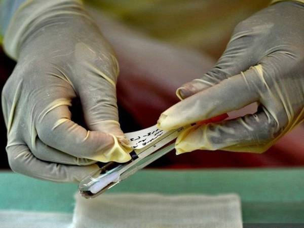 NTF menerima 50,000 Kit Ujian Rapid Antigen (RTK-Ag) Covid-19 daripada Majlis Keselamatan Negara (MKN), untuk petugas barisan hadapan yang terlibat dalam Op Benteng. - Foto Bernama