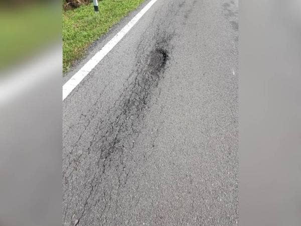 Khairy Jamaluddin cedera selepas beliau dikatakan melanggar lubang ketika berbasikal pada Ahad.