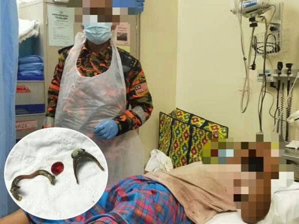 Anggota bomba berjaya memotong dua bentuk cincin yang berada di kemaluan mangsa di HSB Alor Setar pada Jumaat.