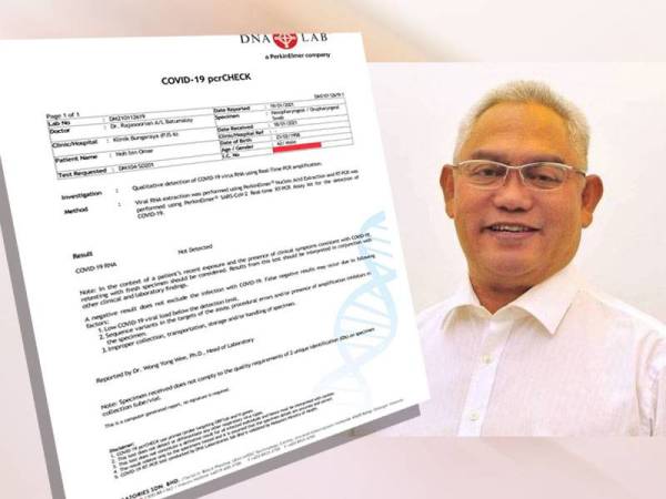 Noh berkongsi keputusan saringan Covid-19 yang diterimanya pada petang Selasa.