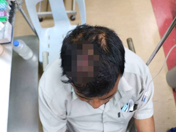 Mangsa mengalami kecederaan di bahagian kepala selepas diserang suspek.