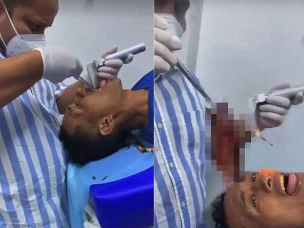 Doktor berjaya mengeluarkan ikan yang tersekat dalam kerongkong pemuda berkenaan. - Agensi