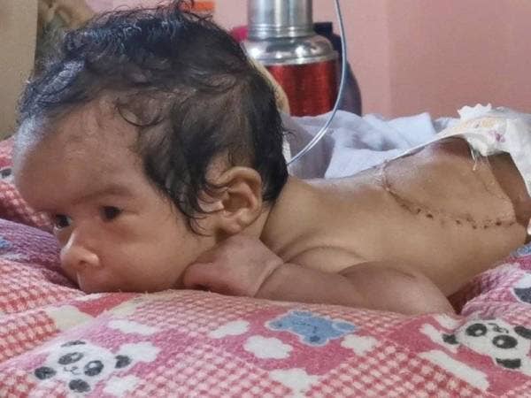 Sayyid Uwais Al-Qarni atau digelar Adam menghidapi penyakit saraf, 'myelomeningocele with encephalocoele' dan telah menjalani pembedahan pada saraf tunjang seawal usia tujuh hari.