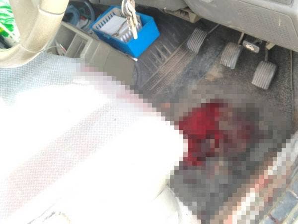 Tompokan darah mangsa ditemui di bahagian tempat letak kaki pemandu dalam kereta miliknya.