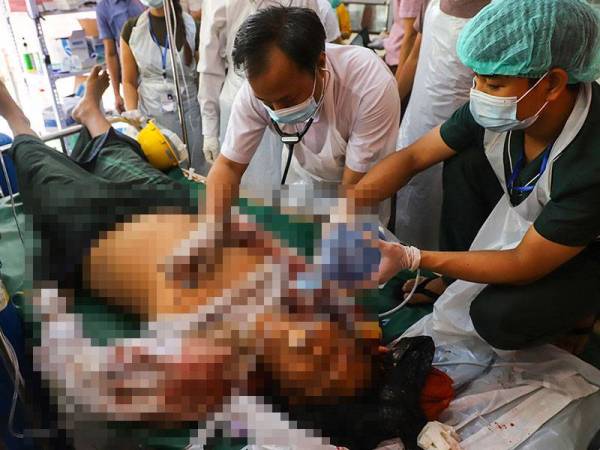 Seorang penunjuk perasaan yang cedera akibat terkena tembakan peluru hidup dirawat di pusat perubatan sementara di Mandalay.