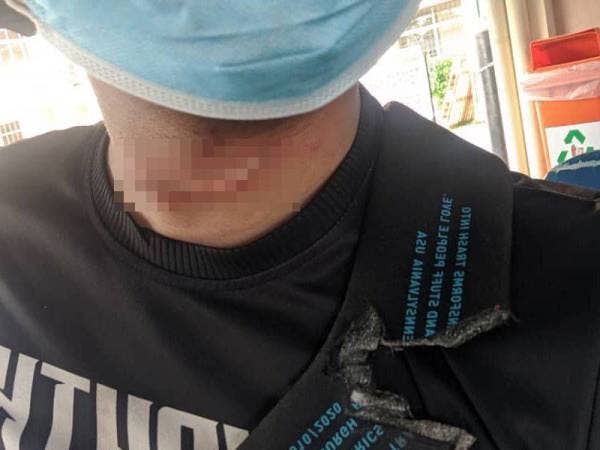 Kecederaan yang dialami mangsa pada bahagian leher.