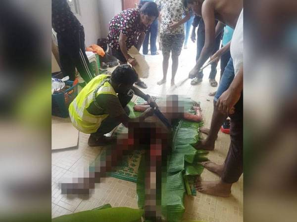 Seorang kanak-kanak lelaki berumur 10 tahun melecur seluruh badan akibat kebakaran yang berlaku di rumahnya.