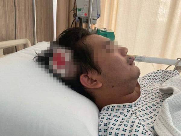 Mangsa cedera termasuk patah gigi selepas dibelasah di lampu isyarat, Jalan Kolam, Kota Kinabalu.