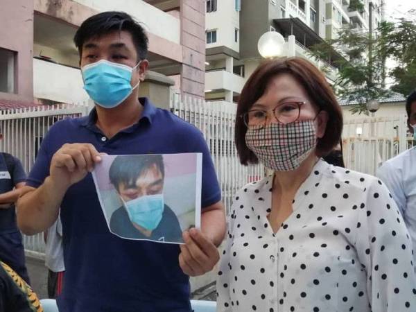 Mr Lee (kiri) menunjukkan kecederaan dialaminya.