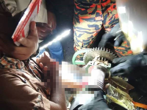Keadaan tangan mangsa yang tersepit pada mesin pemerah tebu dalam kejadian di Taman Serkam Jaya, Merlimau pada Jumaat.