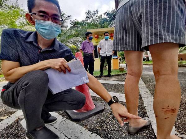 Cheng Foo Cheen menunjukkan betis isterinya yang cedera diserang anjing jiran.