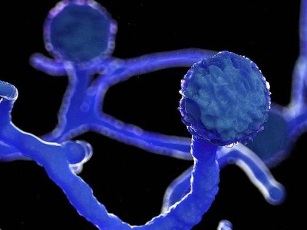 Pada kebiasaannya kulat hitam ditemui pada tumbuh-tumbuhan dan buah-buahan yang rosak. -Foto Getty Images