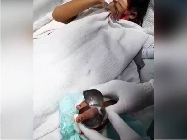 Pasukan Bomba dan Penyelamat berusaha mengeluarkan jari mangsa yang tersekat pada tombol pintu. - Foto ihsan bomba