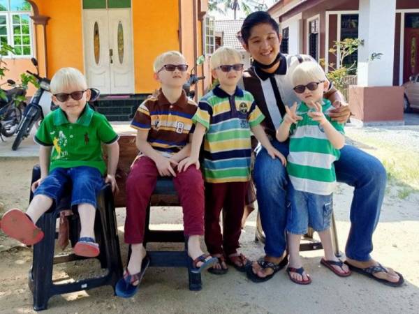 Empat beradik albino mulai tular di laman sosial Tik Tok selepas aksi mereka dikongsi oleh sepupu, Muhd Faisal (kanan).