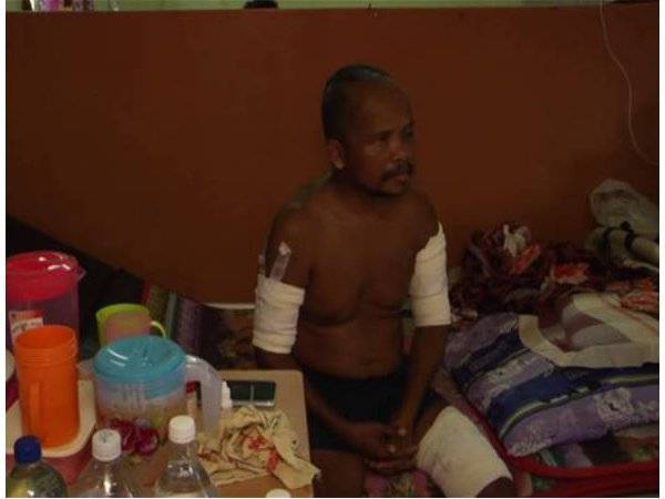 Adin sebelum ini mengalami luka di bahagian lengan kanan dan kiri serta mata. - Foto Awani