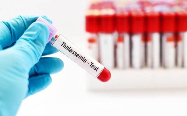 Gambar hiasan. - Foto 123rf